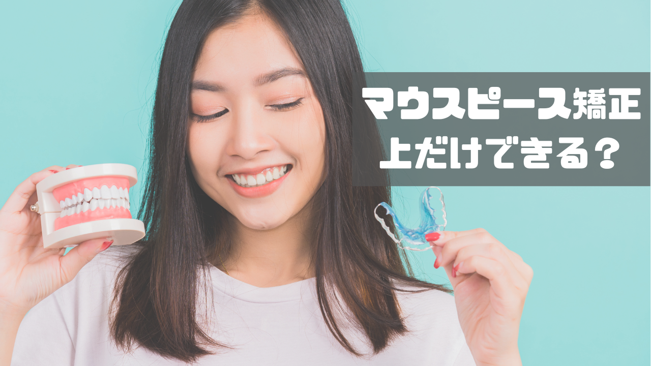 マウスピース矯正　上だけ